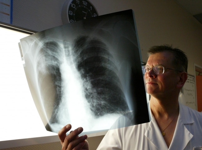 Tour savoir sur le salaire des pneumologues