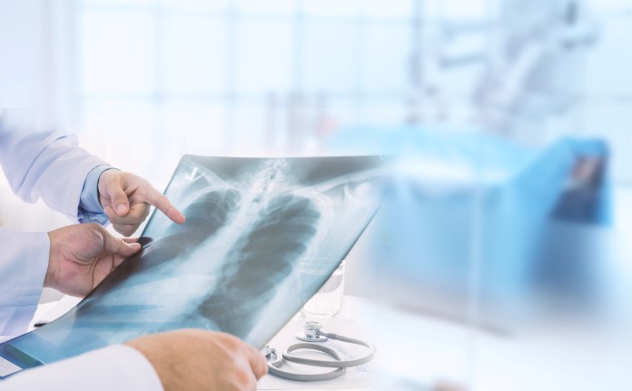 Pneumologue : chiffres clés 