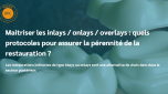 Maitriser les inlays / onlays / overlays : quels protocoles pour