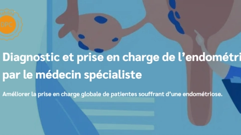Diagnostic et prise en charge de l’endométriose par spécialiste