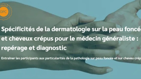 Dermatologie sur peau foncée-cheveux crépus, repérage et diagnost