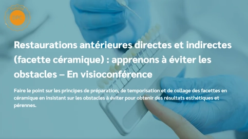 Facette céramique, Restaurations antérieures directes et indirect