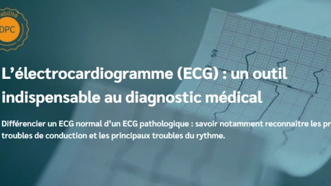 L’électrocardiogramme (ECG) : outil indispensable au diagnostic