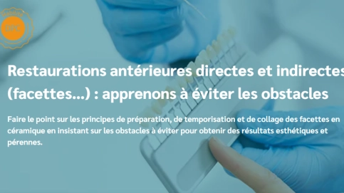 60.PNG Restaurations antérieures directes et indirectes (facettes…) : ap