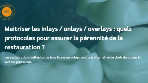 Maitriser les inlays / onlays / overlays : quels protocoles pour