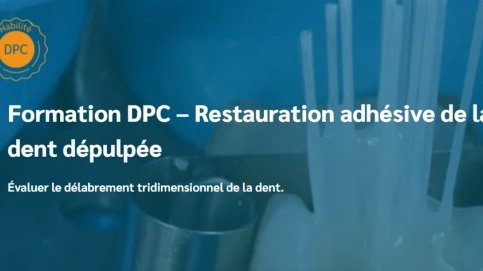 Restauration adhésive de la dent dépulpée - Formation DPC