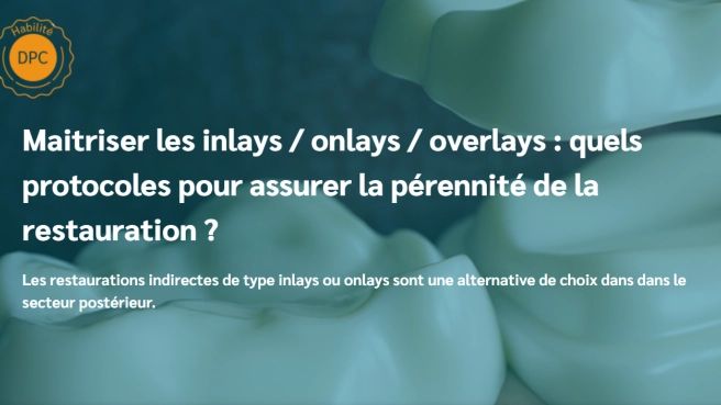 Se remettre en forme en endodontie : les clés et les techniques a