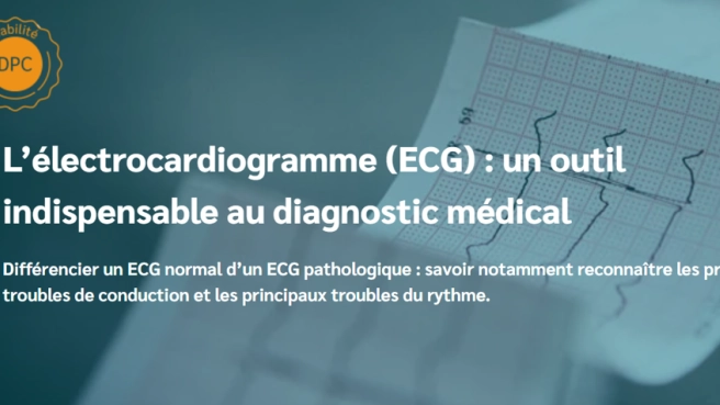 L’électrocardiogramme (ECG) : outil indispensable au diagnostic